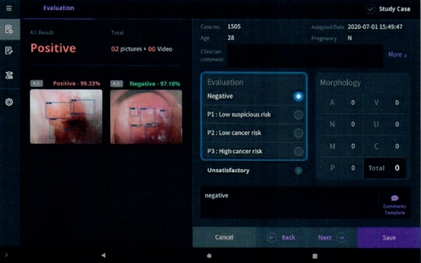  인공지능 기반 자궁경부암 의료영상 보조 진단소프트웨어 (사진=아이도트 제공)