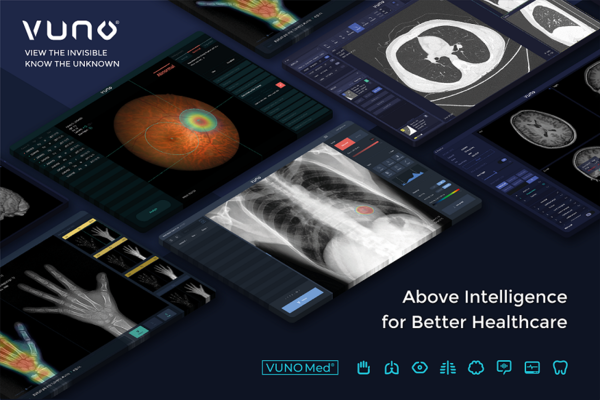 코스닥 상장 위한 예비심사 통과한 뷰노(사진=뷰노 제공)