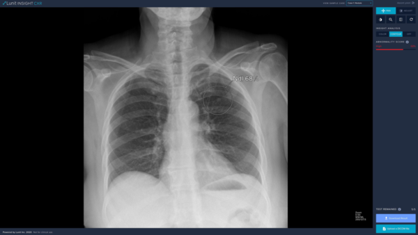 루닛 인사이트 CXR 데모 사진(사진=루닛 제공)