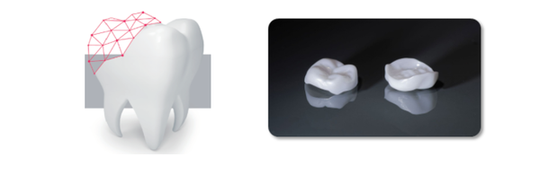 3D 프린팅으로 제작된 제품 외형 '심미치관재료'