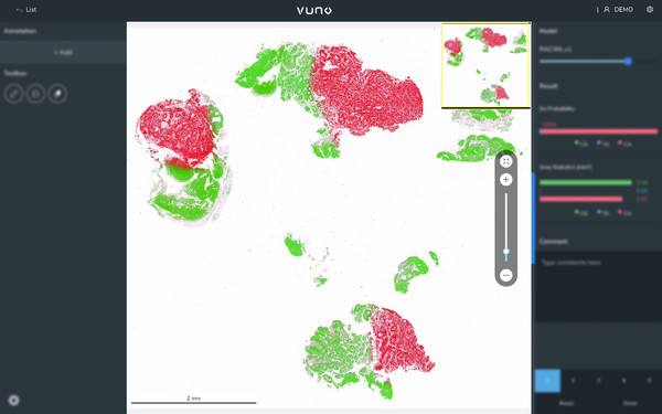 뷰노메드 패스GC AI™(사진=뷰노 제공)