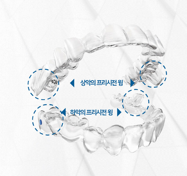 인비절라인이 ‘MA(Mandibular Advancement, 맨디뷸러 어드밴스먼트)’를 출시했다
