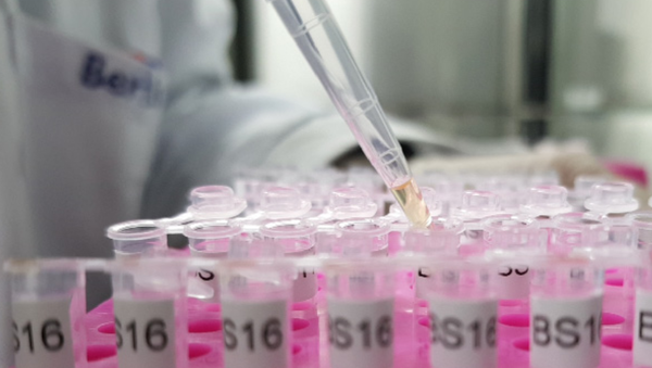 베르티스가 개발한 유방암 진단 솔루션 '마스토체크'