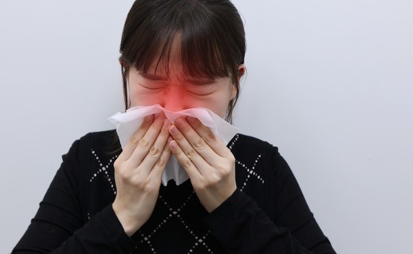 알레르기비염 이미지. (사진=고려대학교 안암병원 제공)