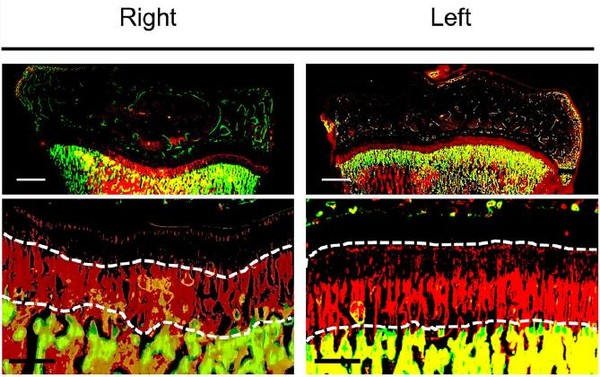 좌측 정강이뼈의 성장판에서 10mm 떨어진 위치에 구멍을 만들고 신생골에 대한 조직학적 분석을 시행한 결과 반대쪽에 비해 뚜렷한 성장 자극 효과를 보여줌. (자료=인제대학교 해운대백병원 제공)